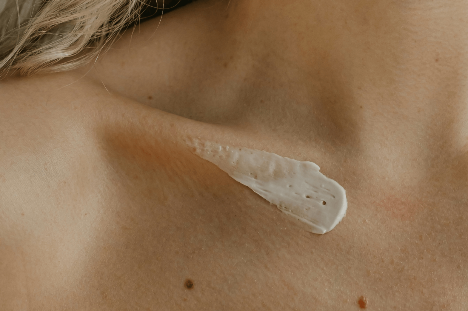 Биорепарация кожи, чекап, «Пептидная терапия» и еще 5 процедур, которые стоит сделать после лета