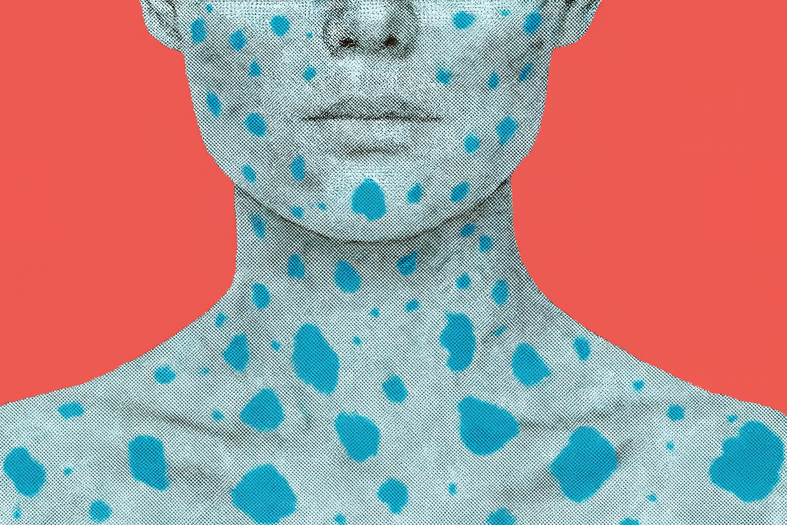 Как убрать пигментацию на лице: эффективные средства 2026